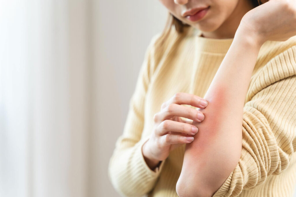 What Skin Concerns Can We Help With?